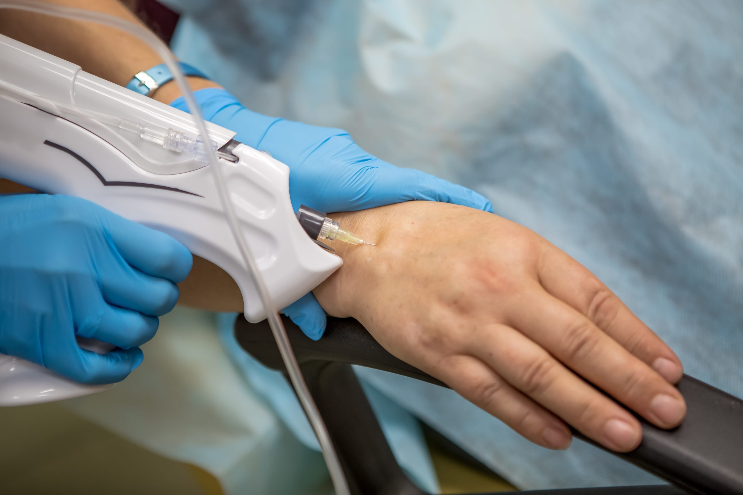 CO2 Hand Rejuvenation Treatment at Skin and Tonic | Pace, Florida, US